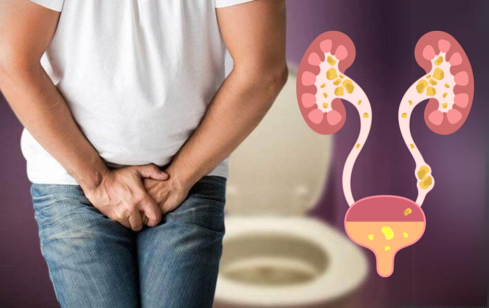 Tại Sao Nhịn Tiểu Gây Sỏi Thận? Hiểu Để Bảo Vệ Sức Khỏe Của Bạn